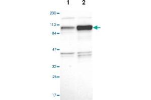 Western blot analysis of Lane 1: Human cell line RT-4, Lane 2: Human cell line U-251MG sp with NCAPH polyclonal antibody  at 1:100-1:250 dilution. (NCAPH antibody)