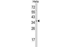 Western blot analysis of STRAP Antibody (C-term) in Hela cell line lysates (35ug/lane). (STRAP antibody  (C-Term))