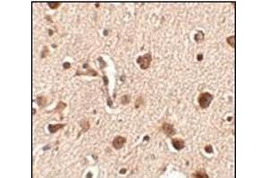 Immunohistochemistry of Slitrk4 in human brain tissue with this product at 2.