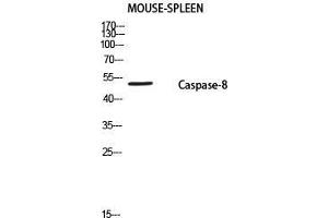 Western Blot (WB) analysis of Mouse Spleen using Caspase-8 P18 antibody. (Caspase-8 p18 antibody  (cleaved, Ser217))