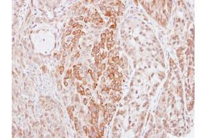IHC-P Image Immunohistochemical analysis of paraffin-embedded A549 xenograft, using Kininogen 1, antibody at 1:500 dilution. (KNG1 antibody)