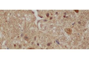 Immunohistochemistry of paraffin-embedded Mouse brain using Aβ40 Polyclonal Antibody at dilution of 1:50 (Abeta 1-40 antibody)