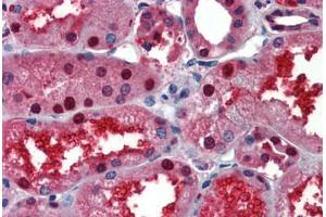 Human Kidney (formalin-fixed, paraffin-embedded) stained with LASS2 antibody ABIN462181 followed by biotinylated goat anti-rabbit IgG secondary antibody ABIN481713, alkaline phosphatase-streptavidin and chromogen. (Ceramide Synthase 2 antibody  (AA 72-121))