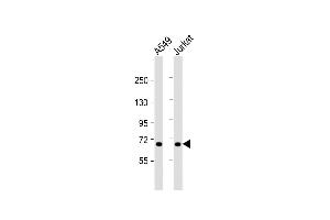 All lanes : Anti-F11 Antibody (Center) at 1:1000 dilution Lane 1: A549 whole cell lysate Lane 2: Jurkat whole cell lysate Lysates/proteins at 20 μg per lane. (Factor XI antibody  (AA 281-307))