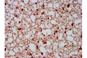 IHC image of ABIN7151037 diluted at 1:500 and staining in paraffin-embedded human brain tissue performed on a Leica BondTM system.