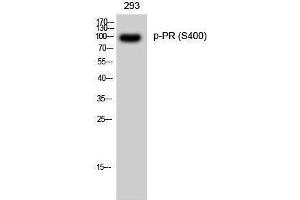 Western Blotting (WB) image for anti-PR (pSer400) antibody (ABIN3182420) (PR (pSer400) antibody)