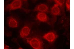 Immunofluorescence staining of methanol-fixed MCF cells using eIF4E(Phospho-Ser209) Antibody. (EIF4E antibody  (pSer209))