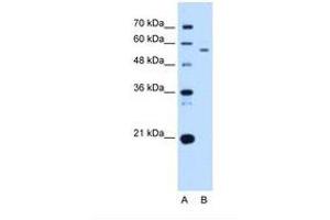 Image no. 2 for anti-UBX Domain Protein 4 (UBXN4) (AA 301-350) antibody (ABIN321312) (UBXD2 antibody  (AA 301-350))