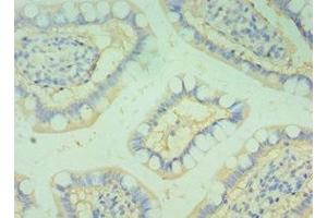 Immunohistochemistry of paraffin-embedded human small intestine tissue using ABIN7145826 at dilution of 1:100 (BOC antibody  (AA 1-125))