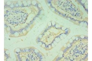 Immunohistochemistry of paraffin-embedded human small intestine tissue using ABIN7145826 at dilution of 1:100