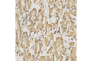 Immunohistochemistry of paraffin-embedded human stomach using PRDX4 antibody at dilution of 1:200 (x400 lens)