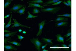 Immunofluorescence of purified MaxPab antibody to FMO3 on HeLa cell. (FMO3 antibody  (AA 1-532))
