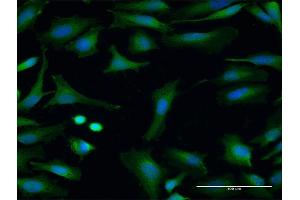 Immunofluorescence of purified MaxPab antibody to FMO3 on HeLa cell.
