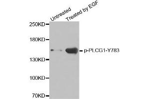 Western Blotting (WB) image for anti-phospholipase C, gamma 1 (PLCG1) (pTyr783) antibody (ABIN1870508) (Phospholipase C gamma 1 antibody  (pTyr783))