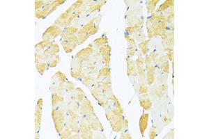 Immunohistochemistry of paraffin-embedded mouse heart using DDX3Y antibody (ABIN6130260, ABIN6139496, ABIN6139497 and ABIN6215395) at dilution of 1:100 (40x lens). (DDX3Y antibody  (AA 1-210))