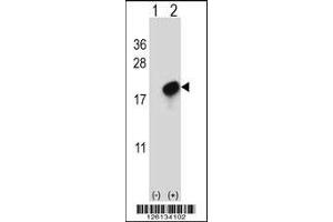 Western blot analysis of CMTM7 using rabbit polyclonal CMTM7 Antibody using 293 cell lysates (2 ug/lane) either nontransfected (Lane 1) or transiently transfected (Lane 2) with the CMTM7 gene. (CMTM7 antibody  (N-Term))