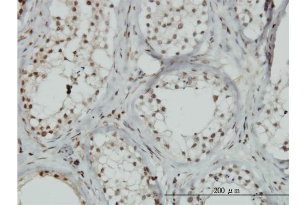 ZNF85 antibody  (AA 2-76)