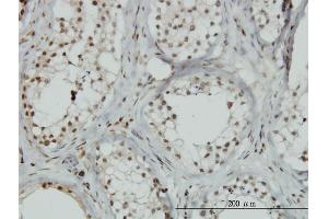 Immunoperoxidase of monoclonal antibody to ZNF85 on formalin-fixed paraffin-embedded human testis.