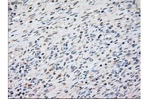 Immunohistochemical staining of paraffin-embedded Ovary tissue using anti-KRT8mouse monoclonal antibody. (KRT8 antibody  (AA 91-381))