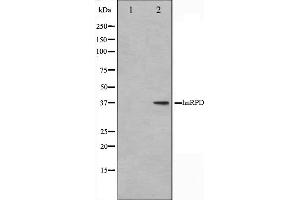 Western blot analysis on HuvEc cell lysate using hnRPD Antibody. (HNRNPD/AUF1 antibody  (Internal Region))
