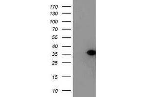HEK293T cells were transfected with the pCMV6-ENTRY control (Left lane) or pCMV6-ENTRY NUBPL (Right lane) cDNA for 48 hrs and lysed. (NUBPL antibody  (AA 1-250))