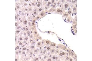 Immunohistochemistry of paraffin-embedded mouse liver using CDKN1A Antibody. (p21 antibody)