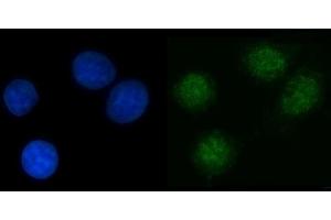 anti-Nuclear Protein Localization 4 Homolog (NPLOC4) (AA 1-495) antibody