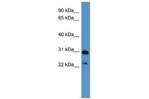 WB Suggested Anti-PHOX2A Antibody Titration: 0. (PHOX2A antibody  (C-Term))