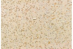 ABIN6260789 and ABIN6272910 at 1/100 staining Rat brain tissue by IHC-P. (CHCHD2 antibody  (Internal Region))