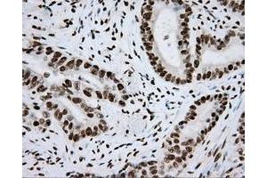 Image no. 8 for anti-Aryl Hydrocarbon Receptor Nuclear Translocator (ARNT) antibody (ABIN1496729) (ARNT antibody)