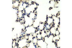 Immunohistochemistry of paraffin-embedded mouse lung using PSMD13 antibody. (PSMD13 antibody  (AA 1-250))