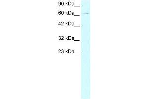 WB Suggested Anti-ZBTB20 Antibody Titration: 2. (ZBTB20 antibody  (Middle Region))