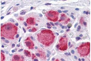 Human Ganglion cells: Formalin-Fixed, Paraffin-Embedded (FFPE) (DARS antibody  (AA 393-501))