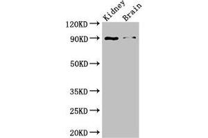 Western Blot Positive WB detected in: Mouse kidney tissue, Mouse brain tissue All lanes: IL4 antibody at 3 μg/mL Secondary Goat polyclonal to rabbit IgG at 1/50000 dilution Predicted band size: 18, 16 kDa Observed band size: 90 kDa (IL-4 antibody  (AA 25-153))