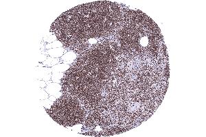 anti-Lysine (K)-Specific Demethylase 6A (KDM6A) (Center) antibody