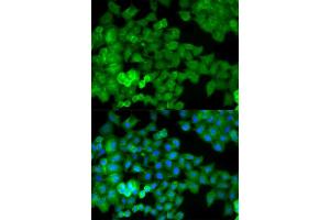 Immunofluorescence analysis of HeLa cells using JUP antibody. (JUP antibody  (AA 1-300))