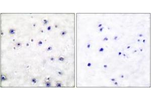 Immunohistochemistry analysis of paraffin-embedded human brain tissue, using Trk A (Ab-791) Antibody.