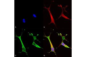 Immunocytochemistry/Immunofluorescence analysis using Mouse Anti-Copper Transporting ATPase 2 Monoclonal Antibody, Clone S62-29 (ABIN2485175). (ATP7B antibody  (AA 3-21) (FITC))