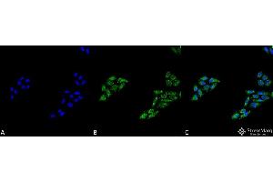 Immunocytochemistry/Immunofluorescence analysis using Rabbit Anti-p53 Polyclonal Antibody . (p53 antibody  (C-Term) (PerCP))