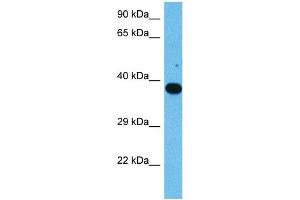 Host:  Mouse  Target Name:  NFKBIE  Sample Tissue:  Mouse Testis  Antibody Dilution:  1ug/ml (NFKBIE antibody  (Middle Region))