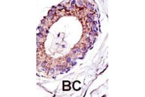 Immunohistochemistry (IHC) image for anti-Ubiquitination Factor E4A (UBE4A) antibody (ABIN3001447)