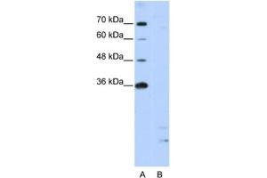 Western Blotting (WB) image for anti-Peptidylprolyl Isomerase E (Cyclophilin E) (PPIE) antibody (ABIN2462198) (PPIE antibody)