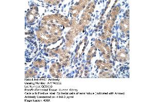 Rabbit Anti-RAE1 Antibody  Paraffin Embedded Tissue: Human Kidney Cellular Data: Epithelial cells of renal tubule Antibody Concentration: 4. (RAE1 antibody  (C-Term))