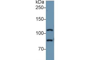 Detection of TLR5 in Human A549 cell lysate using Polyclonal Antibody to Toll Like Receptor 5 (TLR5) (TLR5 antibody  (AA 693-858))