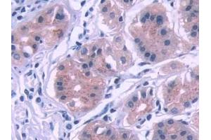 Detection of KEAP1 in Human Stomach Tissue using Polyclonal Antibody to Kelch Like ECH Associated Protein 1 (KEAP1) (KEAP1 antibody  (AA 327-624))