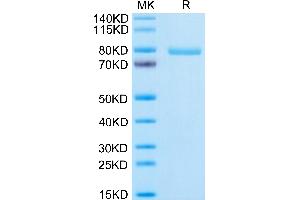 NOTCH3 Protein (AA 40-467) (Fc Tag)