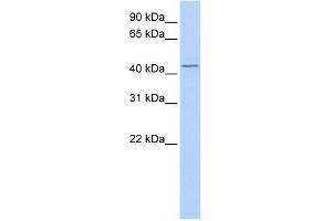 TRABD antibody used at 1 ug/ml to detect target protein. (TRABD antibody  (Middle Region))