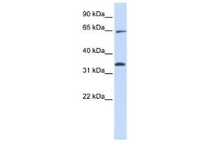 RHOT1 antibody used at 1 ug/ml to detect target protein. (RHOT1 antibody  (Middle Region))