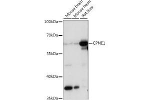 Western blot analysis of extracts of various cell lines, using CPNE1 antibody (ABIN7266499) at 1:1000 dilution. (CPNE1 antibody  (AA 120-220))