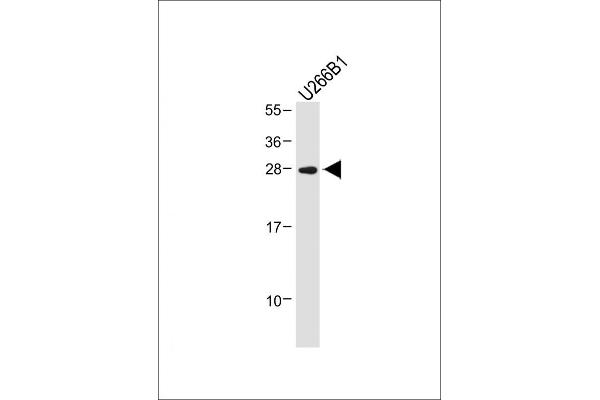 IGLL5 anticorps  (C-Term)